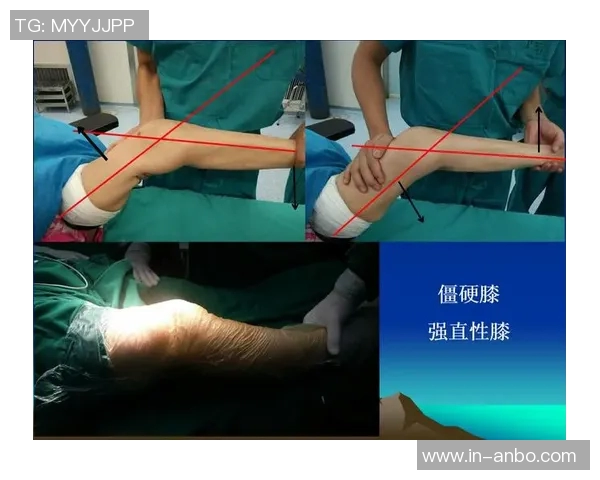 迪巴拉进行左膝关节探查手术后将评估康复时间